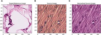 Histopathology image classification: highlighting the gap between manual analysis and AI automation